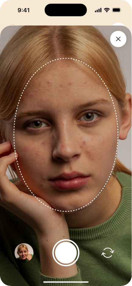 AI Skin Scan